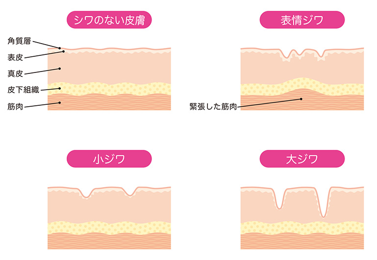 シワのない皮膚 表情ジワ 小ジワ 大ジワ