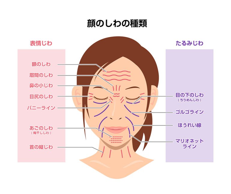 加齢にともなってできる『表情じわ』について