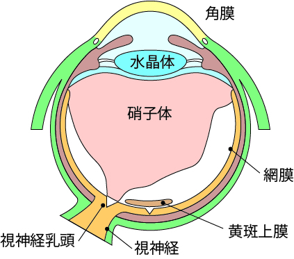 黄斑前膜